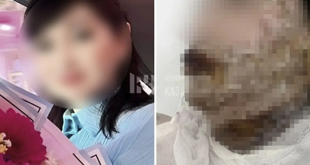 Әйел ауыр жарақат алған: Шымкентте ер адам экс-жұбайының бетіне қышқыл шашқан