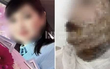 Әйел ауыр жарақат алған: Шымкентте ер адам экс-жұбайының бетіне қышқыл шашқан