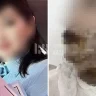 Әйел ауыр жарақат алған: Шымкентте ер адам экс-жұбайының бетіне қышқыл шашқан