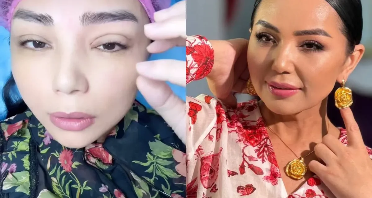 «Екі көзімді де аяқтады»: Алтынай Жорабаева келбетіне өзгеріс енгізгенін айтты