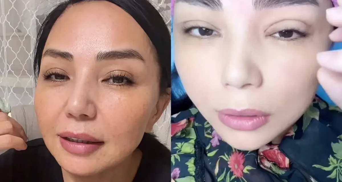 Алтынай Жорабаева көзіне жасатқан косметикалық ота туралы айтты