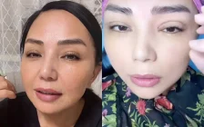 Алтынай Жорабаева көзіне жасатқан косметикалық ота туралы айтты