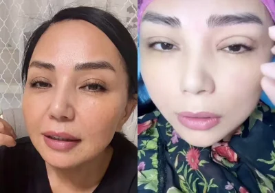 Алтынай Жорабаева көзіне жасатқан косметикалық ота туралы айтты