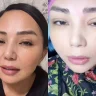 Алтынай Жорабаева көзіне жасатқан косметикалық ота туралы айтты