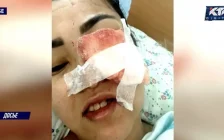 Ақтөбеде тіс емдеуден кейін зардап шеккен әйел клиникаға шағымданды