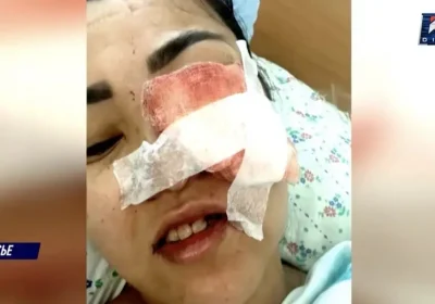 Ақтөбеде тіс емдеуден кейін зардап шеккен әйел клиникаға шағымданды