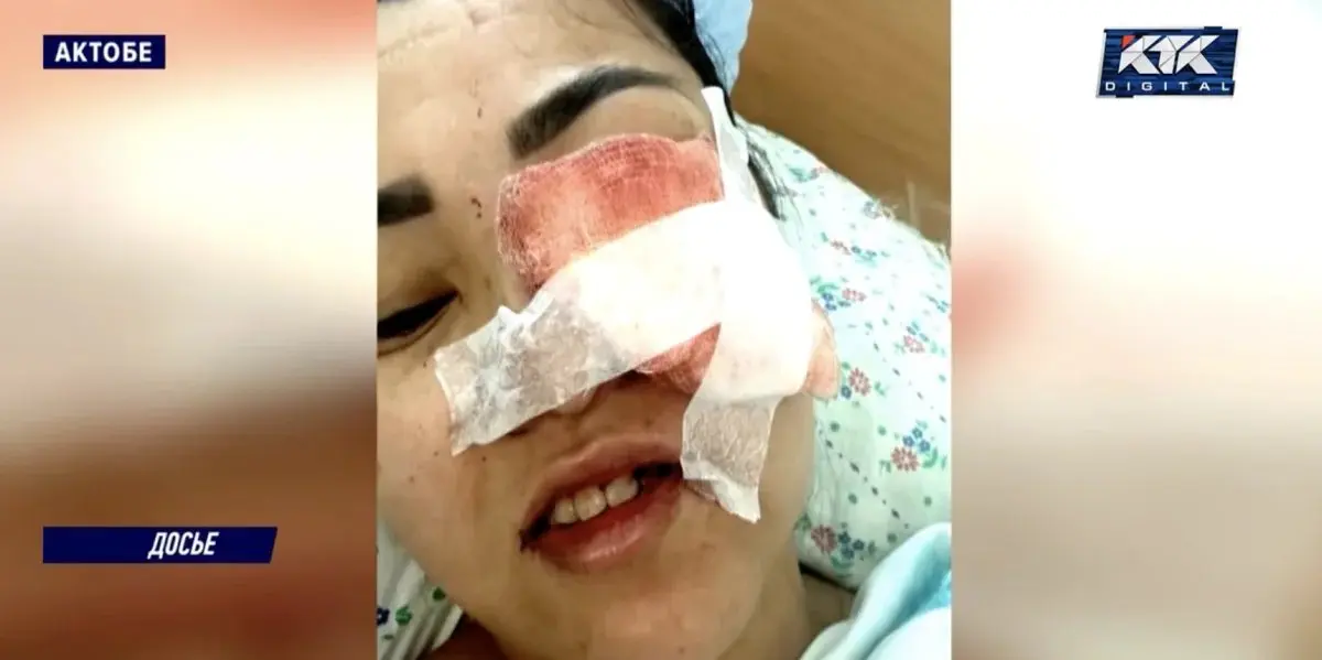 Ақтөбеде тіс емдеуден кейін зардап шеккен әйел клиникаға шағымданды